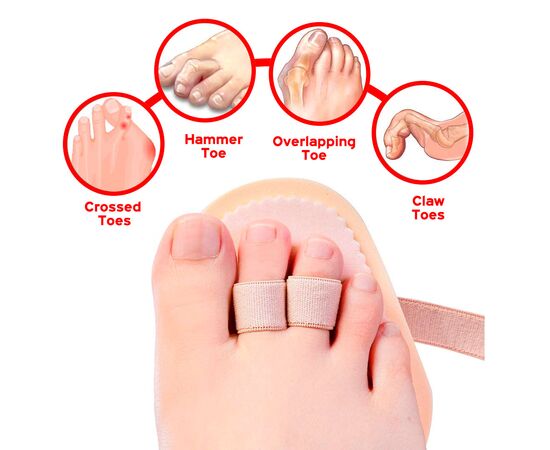 HAMMER TOE SPLINT 2 LOOPS -  στο e-orthoshop